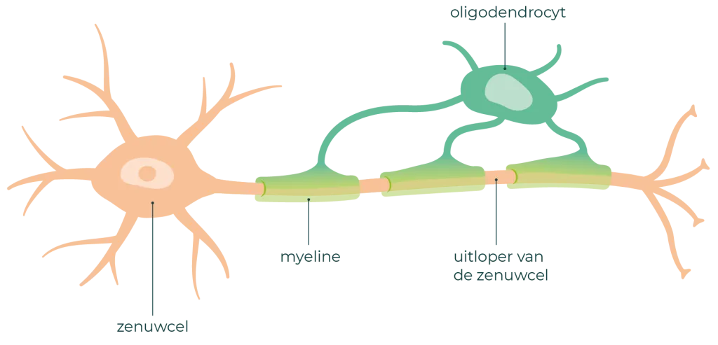 Een oligodendrocyt maakt myeline rond de zenuwuitloper.