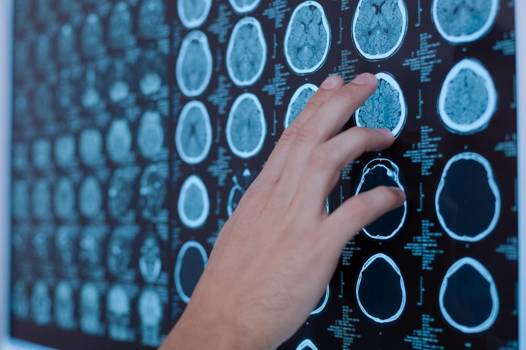 Therapieën bij cognitieve problemen en vermoeidheid: wat helpt?