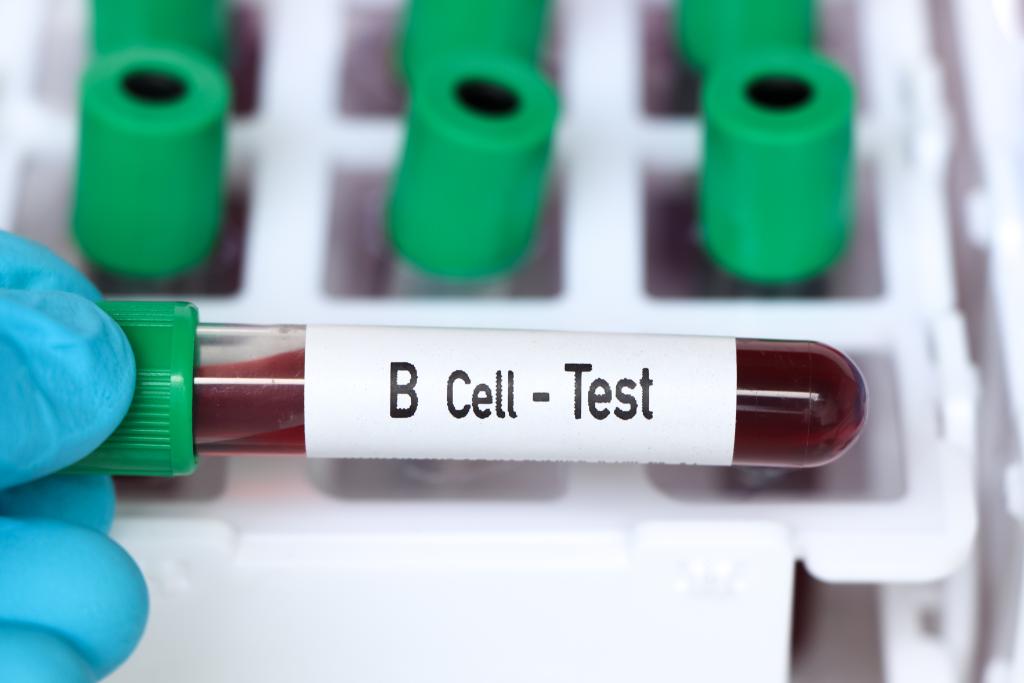 Achteruitgang van RRMS bij minder goede B-cel remming met ocrelizumab