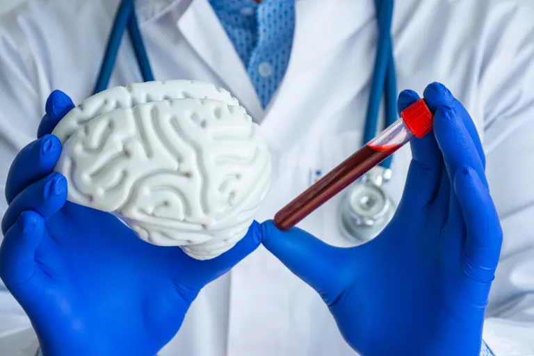 Een betere behandeling met hulp van biomarkers 